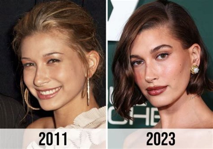 
Hailey Bieber: Before And After 