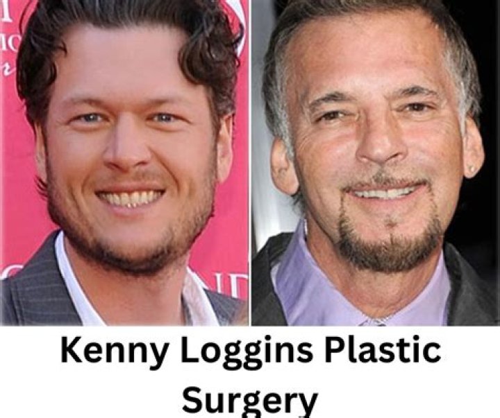 Has Kenny Loggins Had Plastic Surgery? Married Life And His Wives Details
