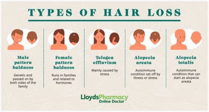 How Did Walter White Become Bald? His Hair Loss Reasons