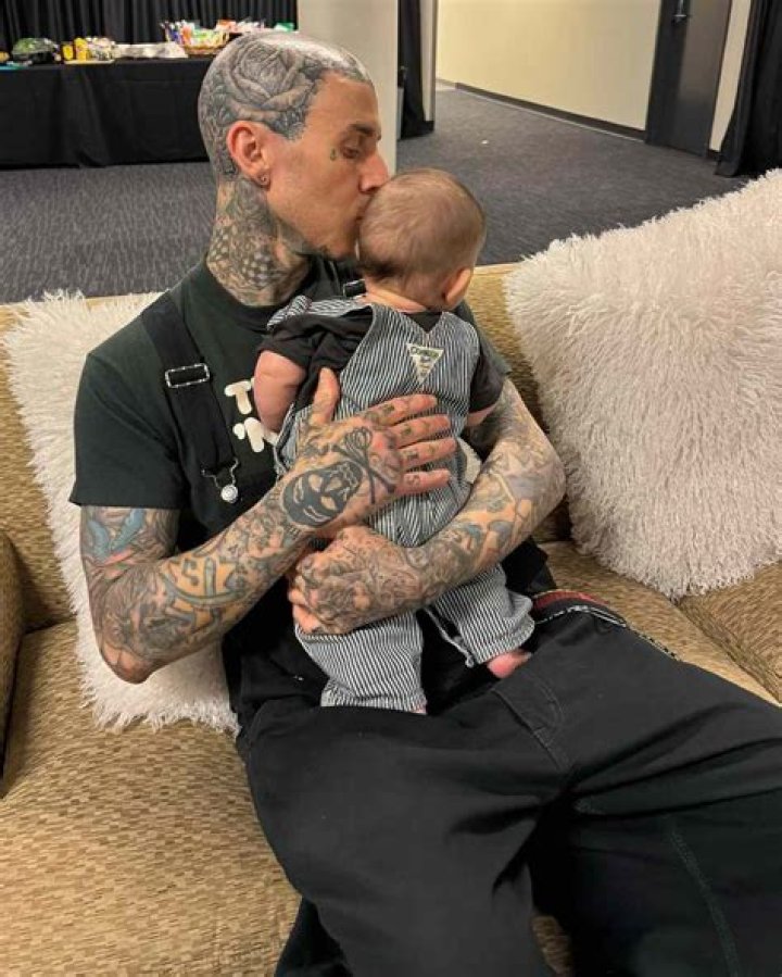 
Is Travis Barker Suffering from Bowel Cancer? Update on health as Alabama’s daughter posts images from the hospital 
