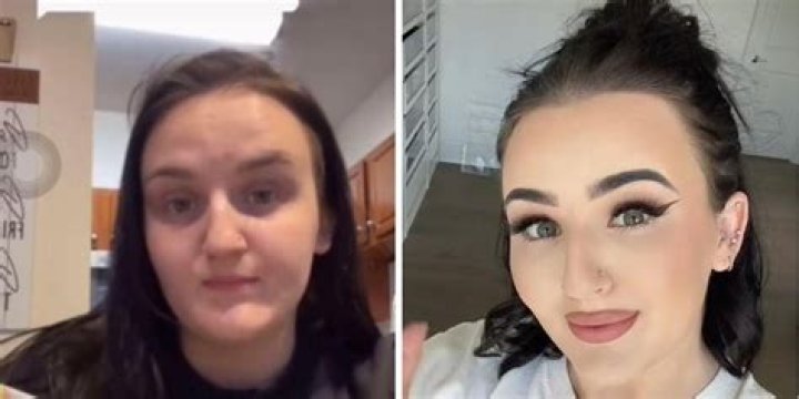 Mikayla Nogueira | Plastic Surgery Before And After