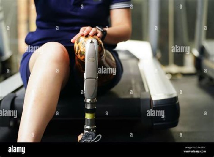 Sophia Lillis Twin Brother Actor Jake Lillis Got His Prosthetic Legs In 2012