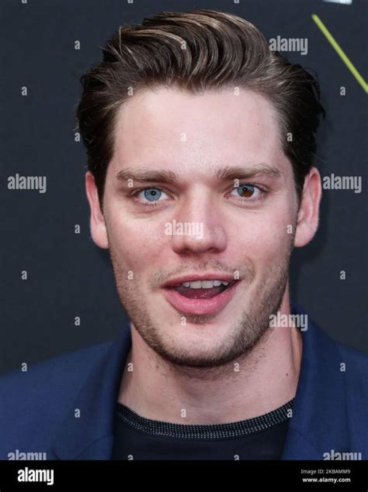 The Hidden Truth About Dominic Sherwood Eyes, Is Different Colored Pupils A Condition?