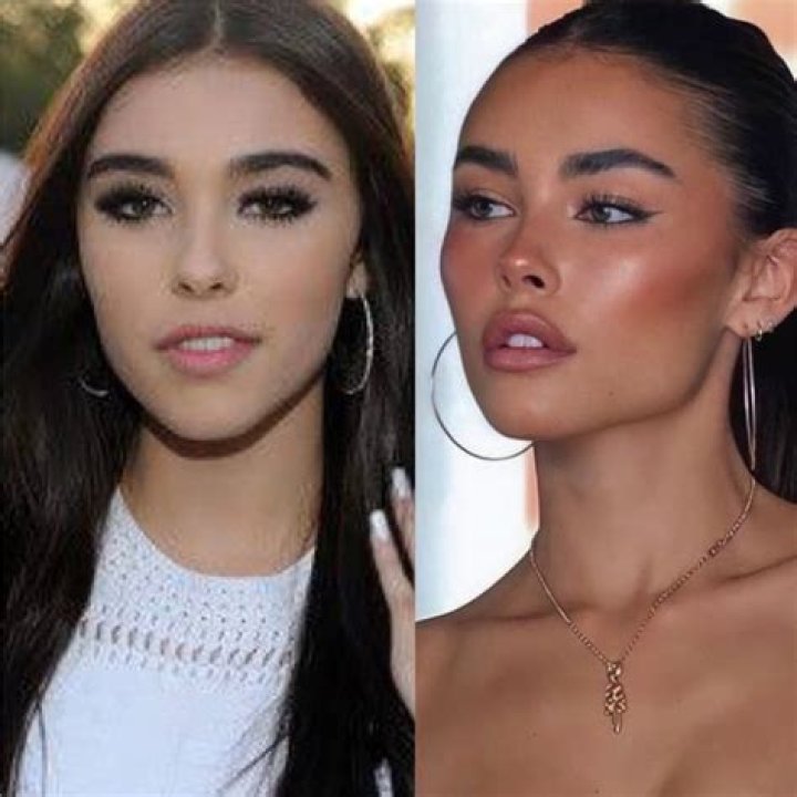 
What Surgery Has Nikita Jasmine Had? Celebs Go Dating Star Shares Pain And Before-After Photos 