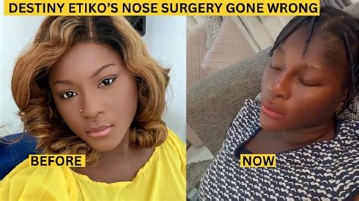 Yes It Is True That Destiny Etiko Had An Accident But She Is Not Dead! Here’s What Happened